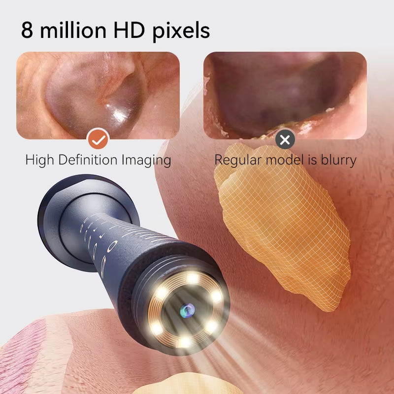Smart Ear Cleaner - HD Camera